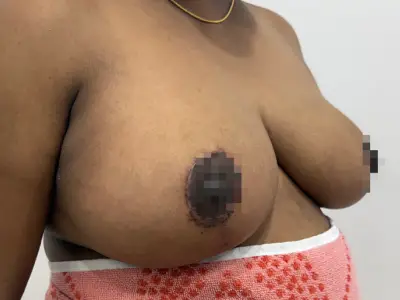 After Image