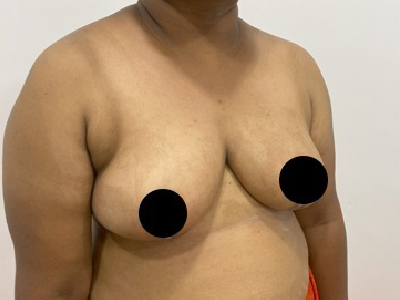 After Image