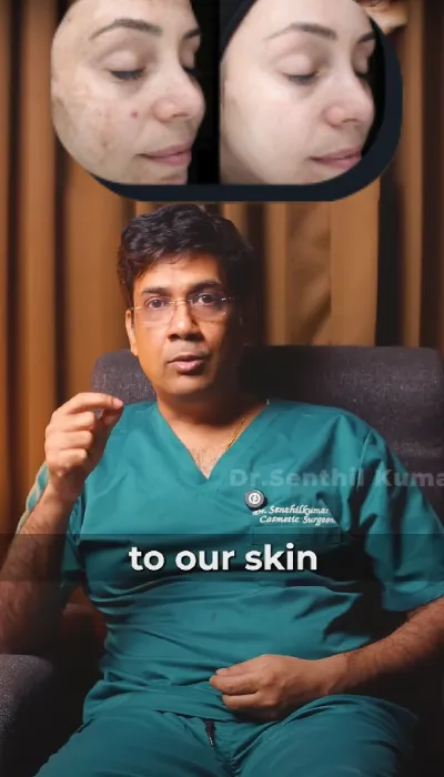 Chemical Peel Facial Treatment