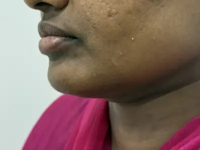 After Image