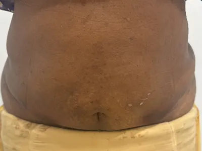 After Image