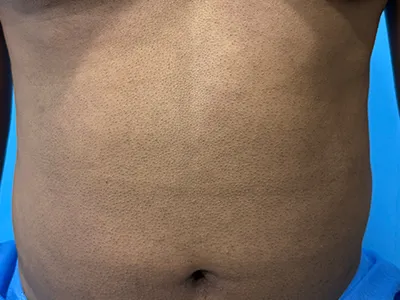 Before Image