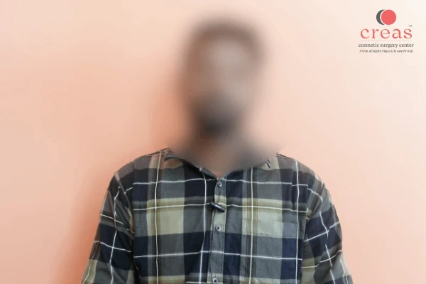 Chest Reduction Patient Feedback