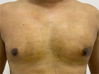 After Image