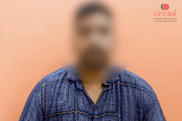 Gynecomastia Surgery Client Testimonials