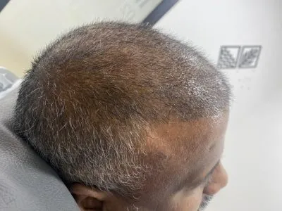 After Image