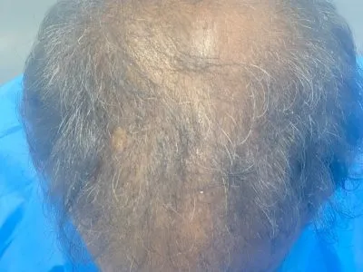 Before Image