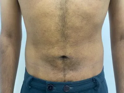 After Image