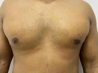 After Image