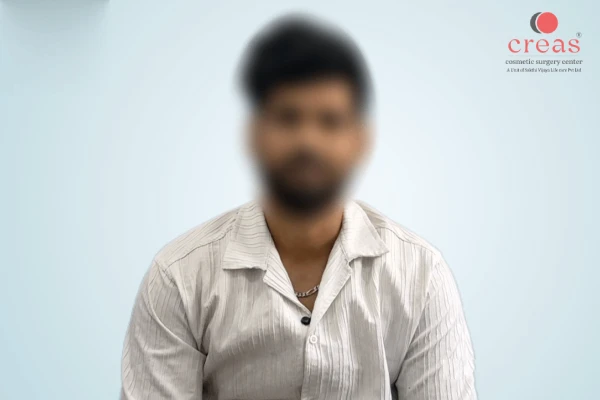 Post Gynecomastia Surgery Experience