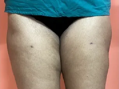 After Image