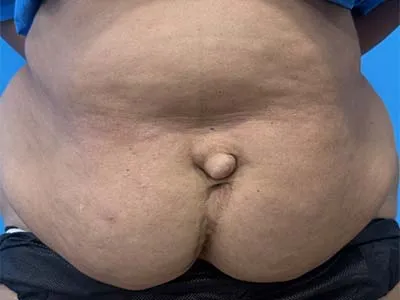 Before Image