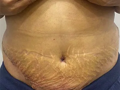 After Image