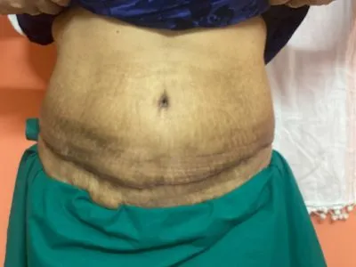 After Image